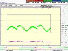 dxsatcs-badr-7-26e-nw-africa-sat-reception-prodelin-450cm-11 018-mhz-h-snrt-laayoune-72H-monitoring-B01