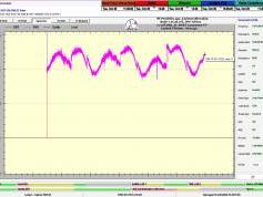 dxsatcs-badr-7-26e-nw-africa-sat-reception-prodelin-450cm-11 018-mhz-h-snrt-laayoune-72H-monitoring-C02